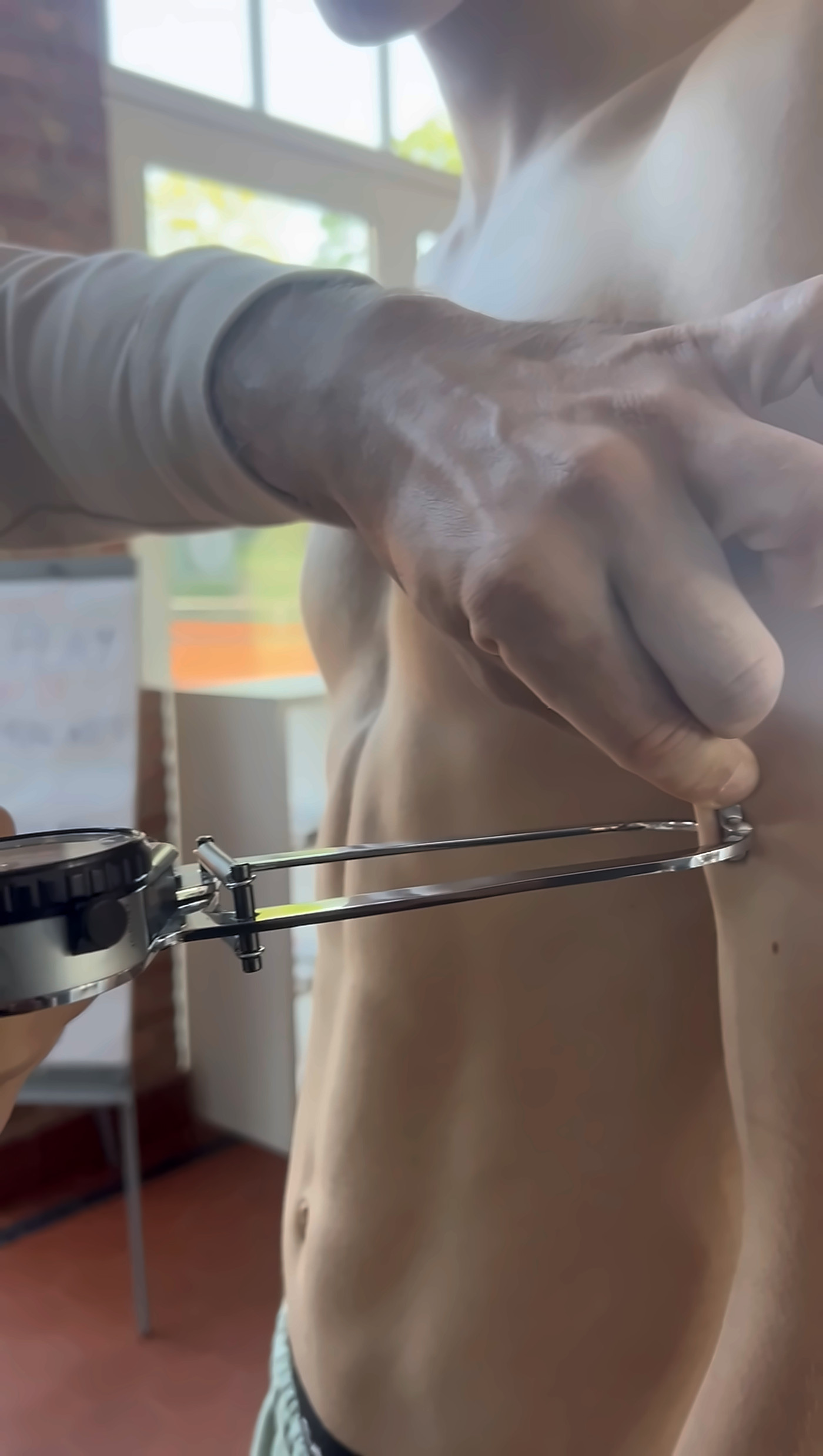 Measuring the suprailiac skinfold of a young footballer with Harpenden callipers